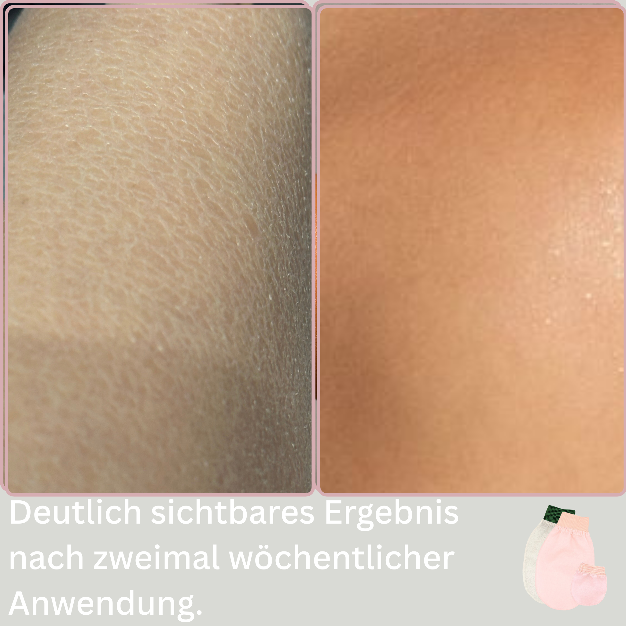 Soft Skin Hamam Peeling Bundle