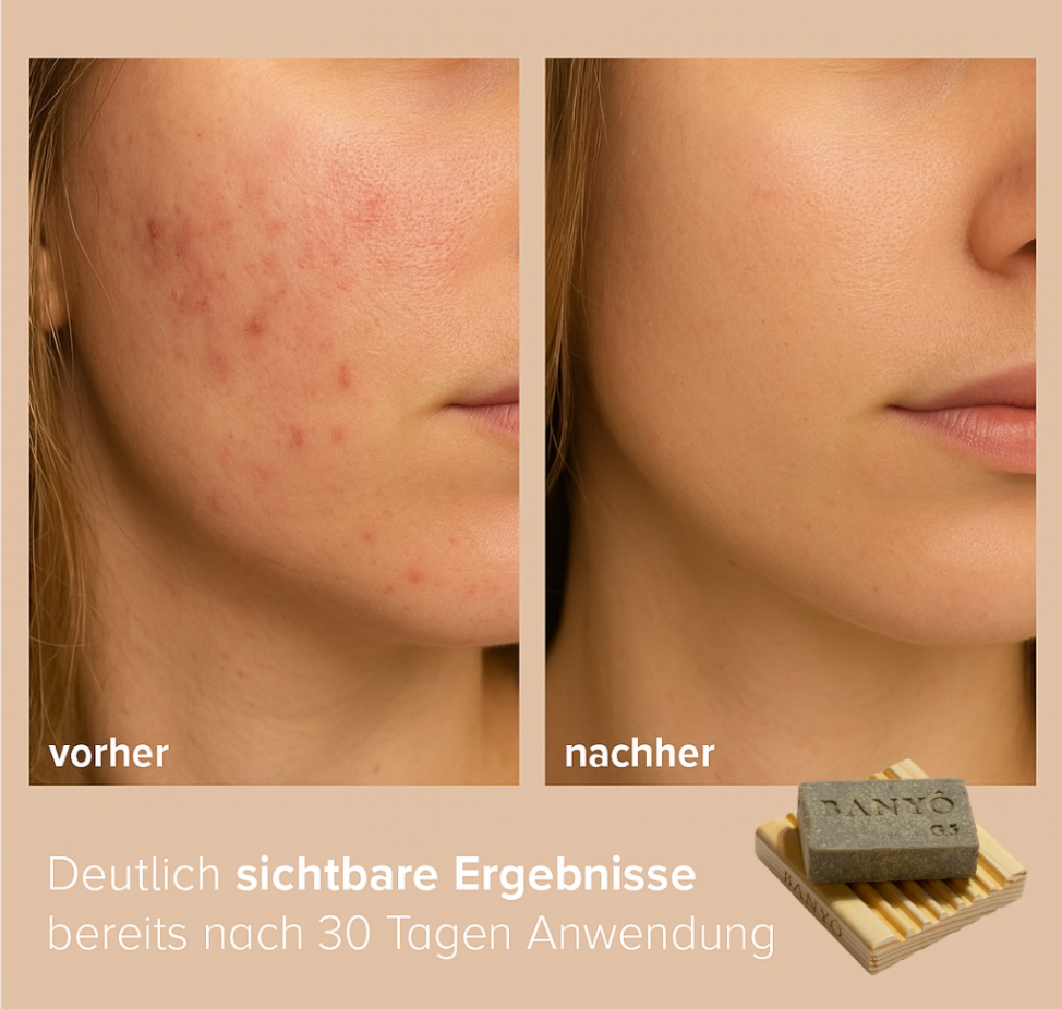 G5 Schwefel Gesichtsseife
